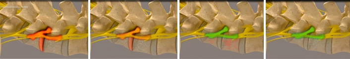 Chiropractic Nashville TN Week 1 Through 4